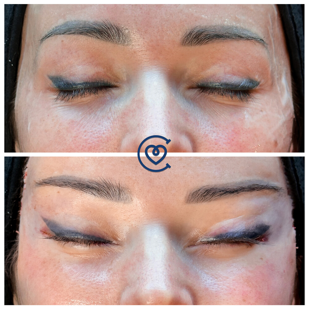 Before and After Result